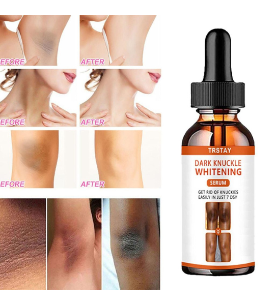 TRSTAY Dark Knuckle Whitening Serum in Pakistan